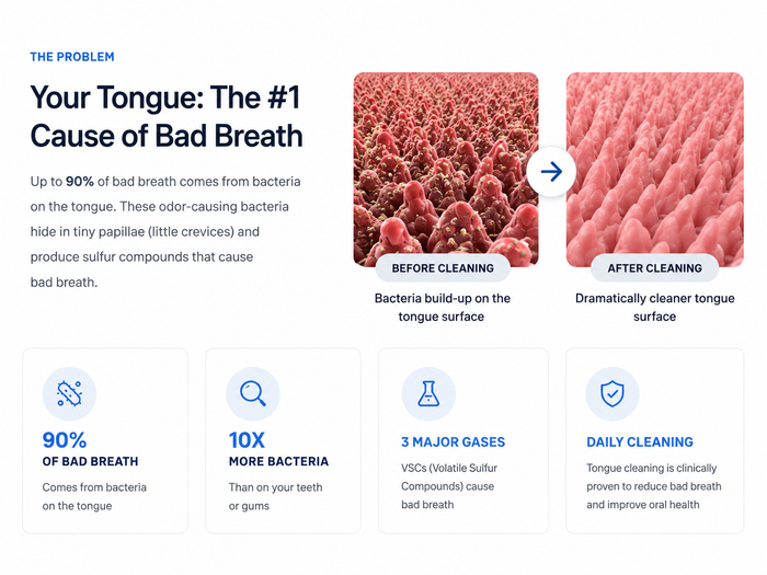 CHASINSMILES Tongue Cleaner image 3
